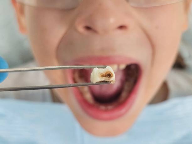 Best Pediatric Emergency Dentist in Dover, NH